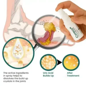 Cvreoz GoutEase Relief Spray | Fast-Acting Gout Pain Relief - Image 5