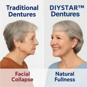 Custom-Fit Functional Dentures - Image 9