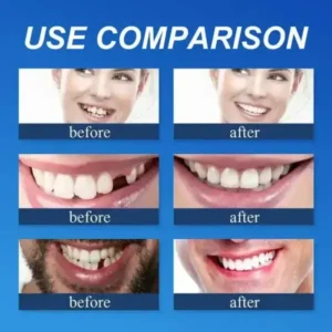 Ends Today: 75% OFF! Full Denture with Strong Suctiond CustomFit Full Functional Dentures🦷 - Image 6
