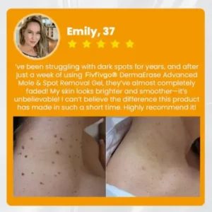 DermaErase Advanced Mole & Spot Removal Gel - Image 7
