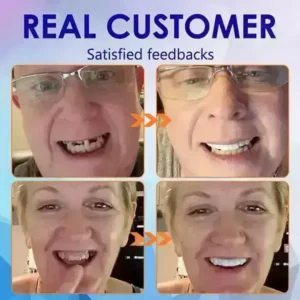 HEATWOLF Full Denture Set | Custom Fit Upper & Lower Dentures - Image 4
