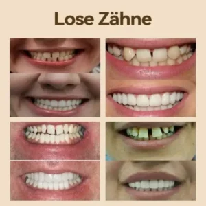 Hidone Premium Gebiss & Zahnprothese aus Silikon kaufen - Image 10
