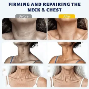 Instant Neck Firming Cream with 5-Ball Roller & Retinol - Image 2