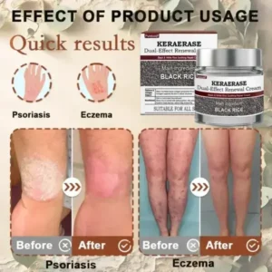 KeraErase DualEffect Renewal Cream - Image 12