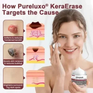 KeraErase DualEffect Renewal Cream - Image 6