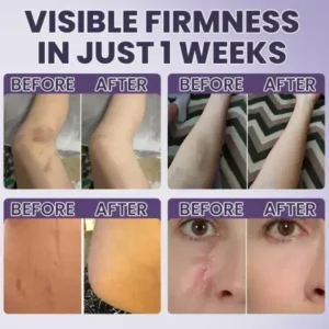 Bruise Repair & Skin-Strengthening Cream - Image 11