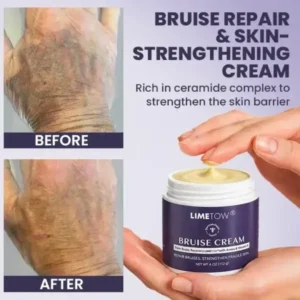 Bruise Repair & Skin-Strengthening Cream - Image 4