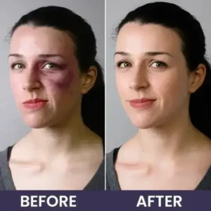 Bruise Repair & Skin-Strengthening Cream - Image 15