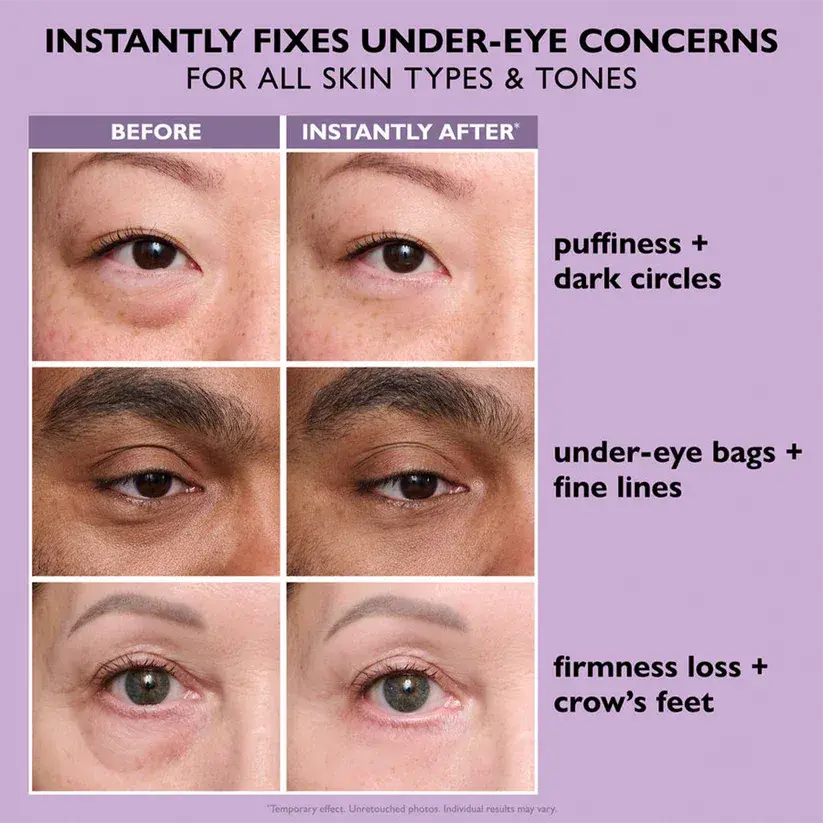 Maiakoo Instant Lift Eye Gel for Puffiness, Bags & Wrinkles - Image 12