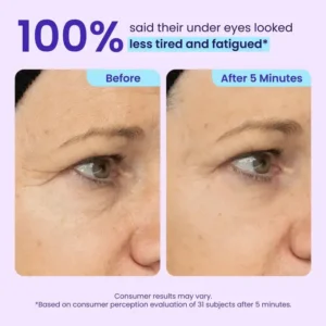 Maiakoo Instant Lift Eye Gel for Puffiness, Bags & Wrinkles - Image 8
