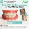 Custom-Fit Full Functional Dentures