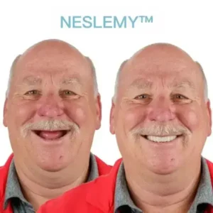 GelFit Dentures - Image 5