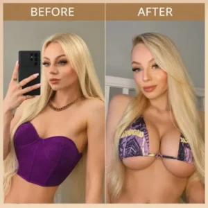 Breast Enhancement Nano Microneedle Patch - Image 8