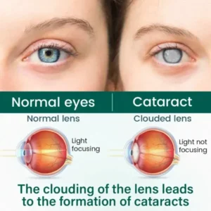 NEYEROS OptiClear Nano Eye Roller Serum - Image 6