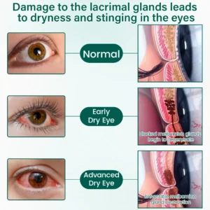 OptiClear Nano Eye Roller Serum - Image 6
