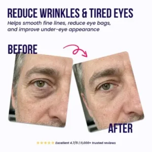 Oros Dissolving Microneedle Eye Patches for Men - Image 7