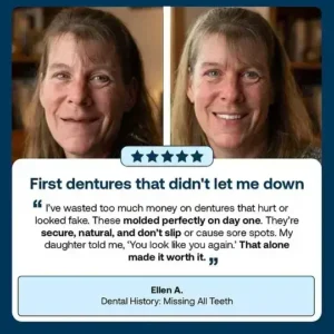 Custom-Fit Full Functional DenturesMake you more confident-Made in the USA - Image 5