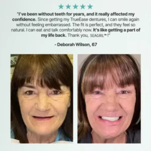Custom-Fit Full Functional Dentures - Image 2