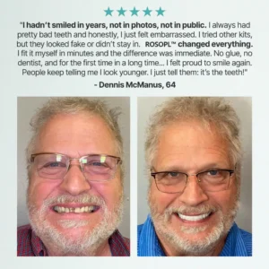 Custom-Fit Functional Dentures - Image 3