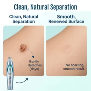 SpotlessPro Advanced Skin Care Pen - Image 8