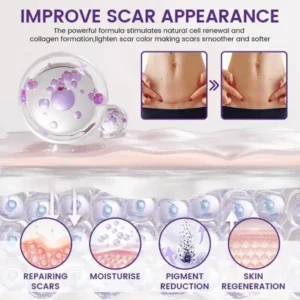 ReGenScar Stem Cell Scar Gel - Image 3