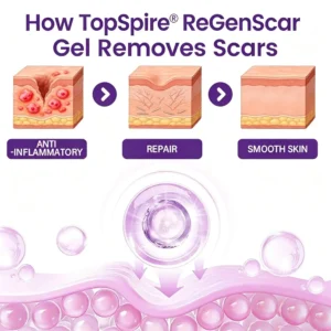 ReGenScar Stem Cell Scar Gel - Image 4