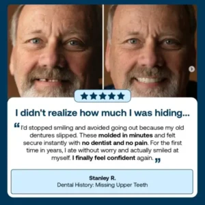 Full Denture with Strong Suction - Image 4