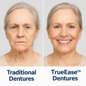 Dentures - Image 7