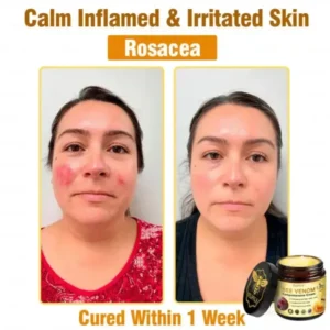 Bee Venom Comprehensive Cream - Image 7