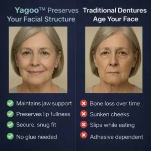 PREMIUM FULL DENTURE SET - Image 3