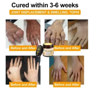 Bee Venom Instant Ultra Strength Pain Relief Therapy Cream - Image 6