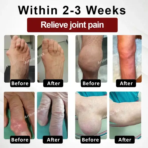 Horse Chestnut Joints and Muscles Massage Gel - Image 2