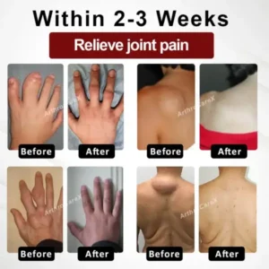 Horse Chestnut Joints and Muscles Massage Gel - Image 3
