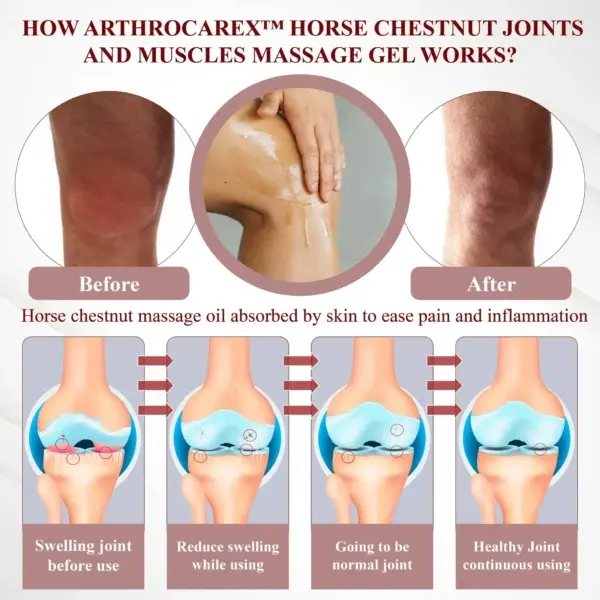 Horse Chestnut Joints and Muscles Massage Gel - Image 6