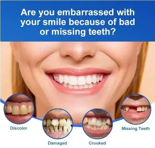 Custom Full Dentures - Image 4