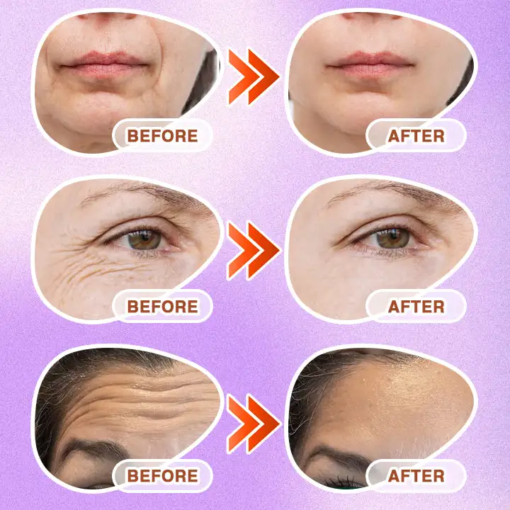 3-in-1 Microneedle Anti-Aging Patch - Image 9