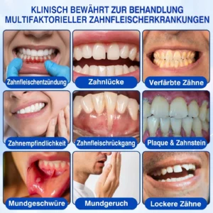 GumRevive Parodontales Reparaturgel - Image 6
