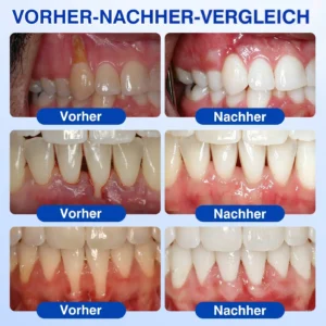 GumRevive Parodontitis Reparaturgel - Image 3