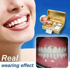 Full Denture - Image 3