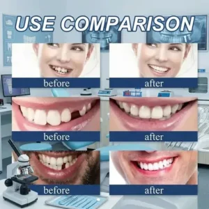 🌎Ends Today: 70% OFF! Custom-Fit Instant Smile Dentures – Natural Looking Comfort Fit - Image 5