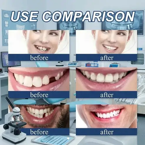 🌎Ends Today: 70% OFF! Custom-Fit Instant Smile Dentures – Natural Looking Comfort Fit - Image 5
