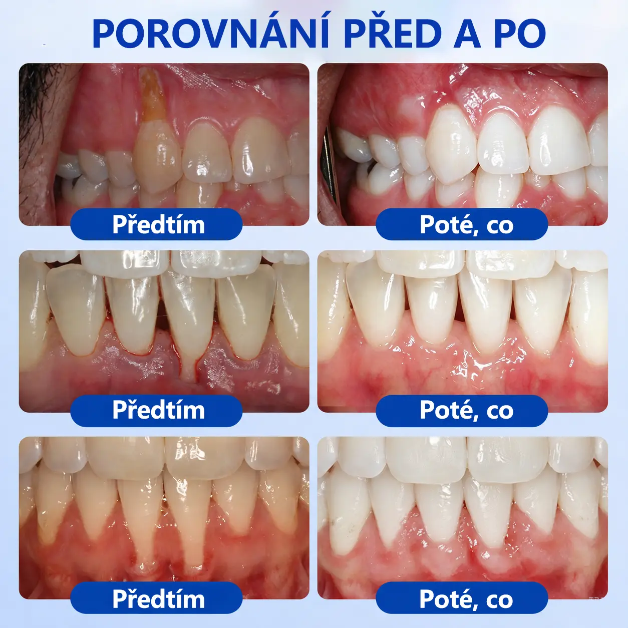 GumRevive Gel - Image 5