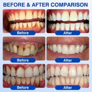GumCare Pro - Image 2