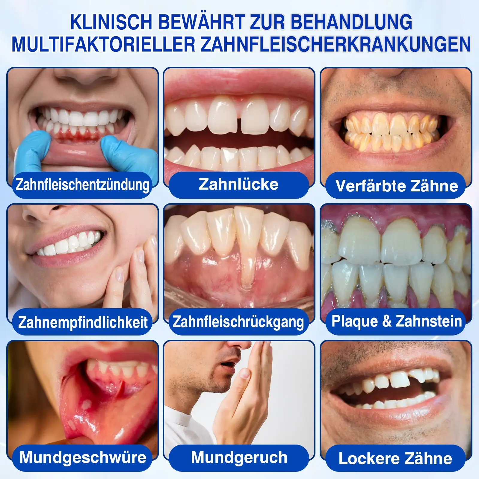 Parodontales Reparaturgel - Image 6