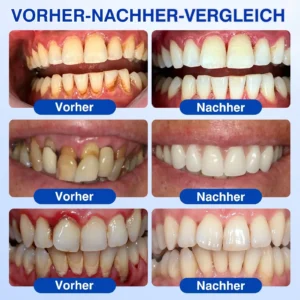 GumRevive Parodontales Reparaturgel - Image 4