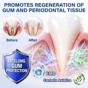 GumRevive Periodontal Repair Gel - Image 11