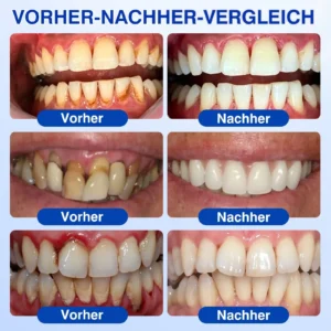 GumRevive Parodontal-Reparaturgel - Image 4