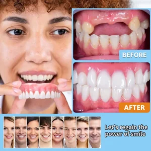 🦷Premium Advanced Customized Full Denture Set 👑 (⏰Limited time discount last 30 minutes) - Image 7