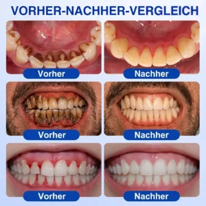 GumRevive Zahnfleisch- Regenerationsgel - Image 4