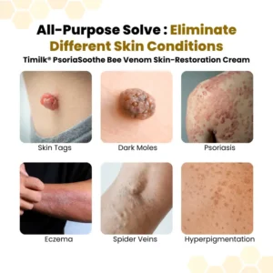 PsoriaSoothe Skin Care Cream - Image 7